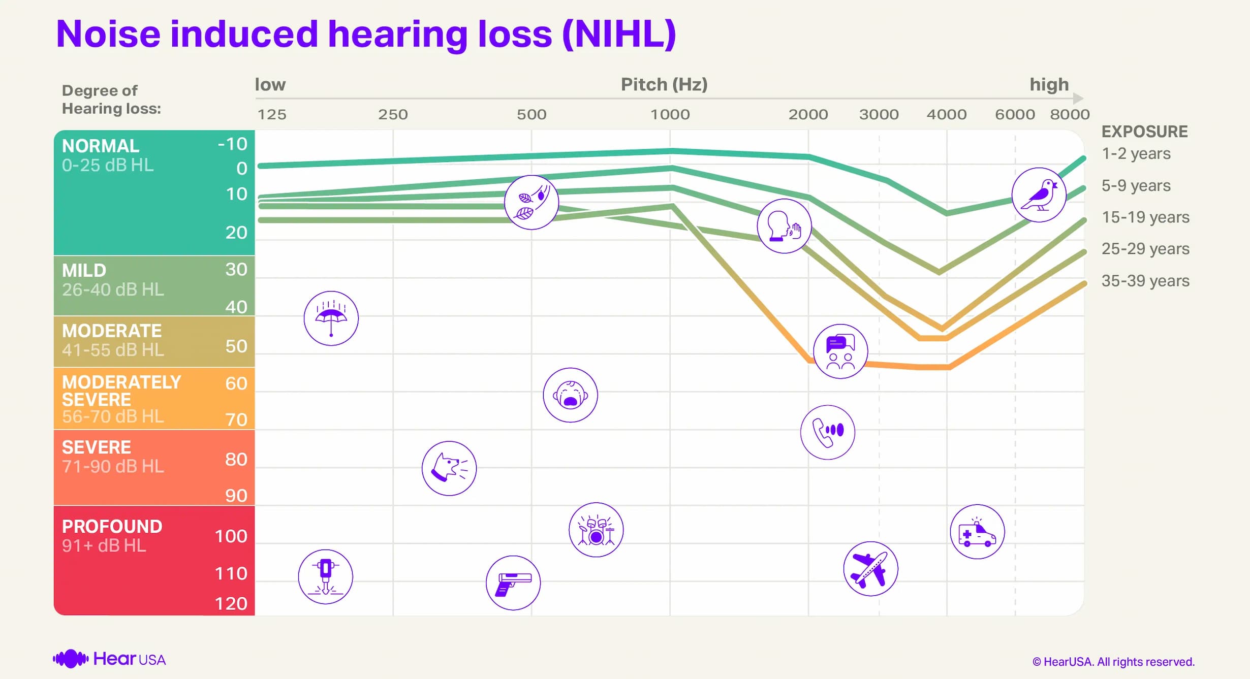 Noise induced hearing loss audiogram