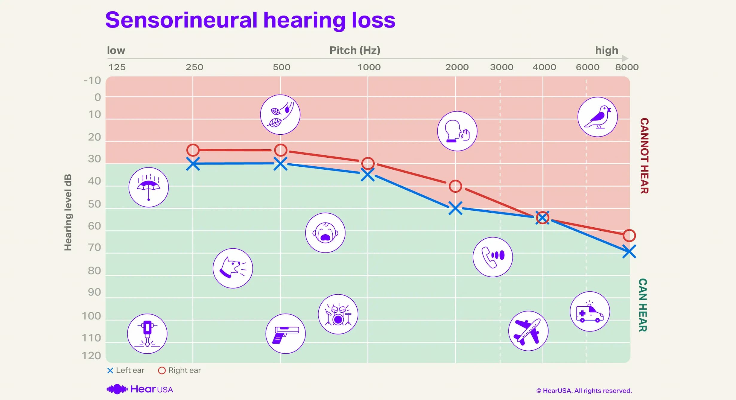 Sensorineural hearing loss audiogram