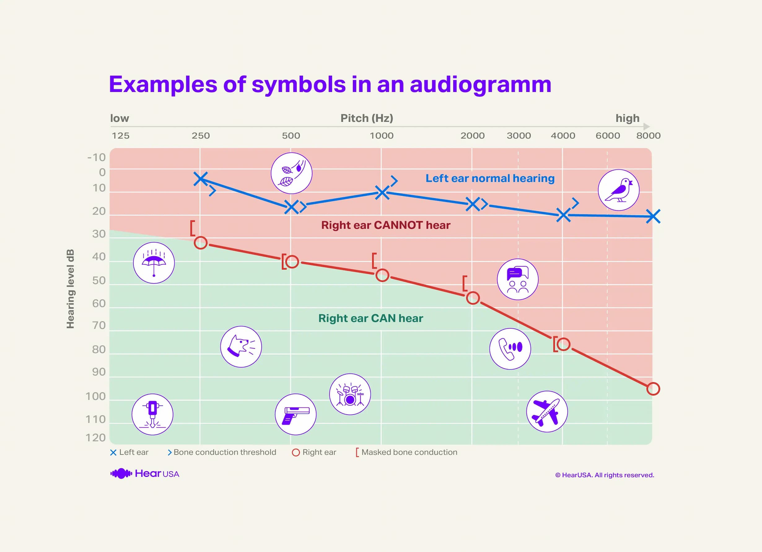 Example of symbols audiogram