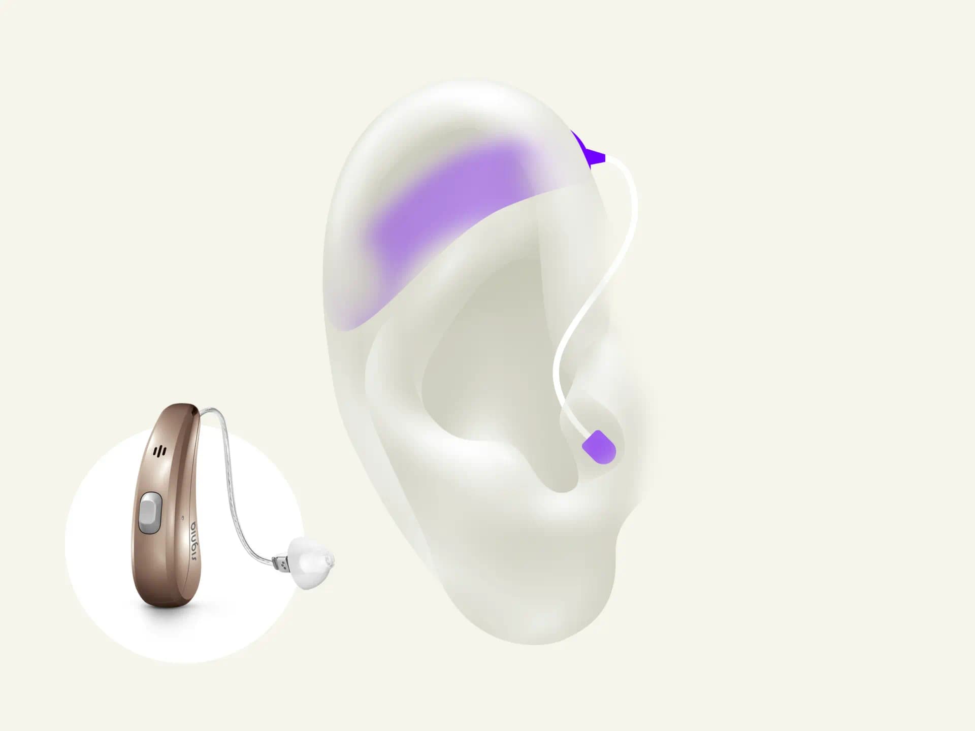 BTE behind-the-ear hearing aid is sits behind your ear with rechargeable battery