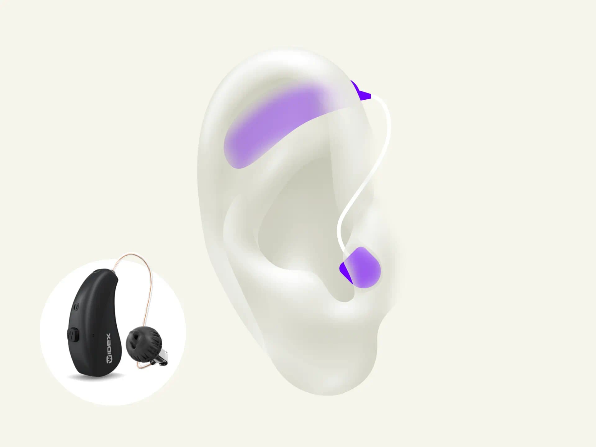 RIC receiver-in-canal-hearing is light and discret sitting behind your ear